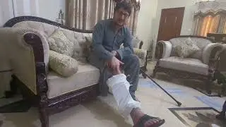 Healing Journey: Tibia & Fibula Fracture Recovery in 4 Months (With Food & Exercise Tips!)