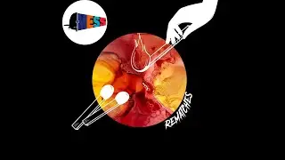 Rematches (prod. by Karismattik) by aM.Ess (SHOT BY @ARTBYALYCIA)