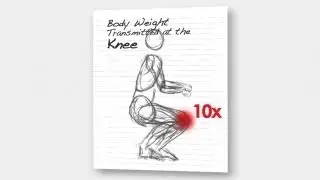 Myth: "Osteoarthritis is a normal part of aging".