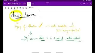 Complete Abortion and Missed Abortion | OG | Obstetrics | Abortion| Easy notes| MeDTecH29