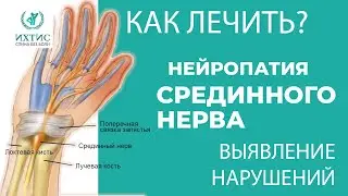 Боли, онемение и покалывания в руках - Компрессионная нейропатия срединного нерва.