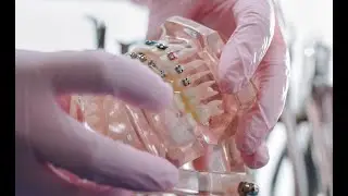 Braces Application Pain-Free