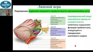 Лицевой нерв симптомы поражения на различных уровнях