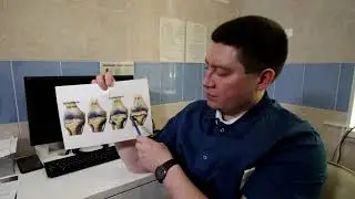 Деформирующий остеоартроз коленного сустава