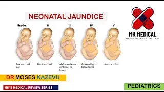 Neonatal Jaundice