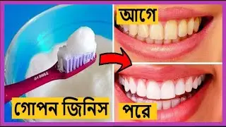লবণ দিয়ে ৭টি অসাধারণ ঘরোয়া চিকিৎসা। 7 wonderful home remedies with salt