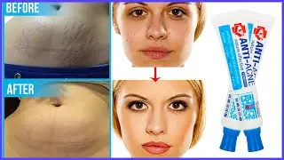 Top 5 Best Scar Removers in 2020