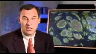 Magic Blood  Stem Cell Therapy Today " KNTV NBC Bay Area" HD