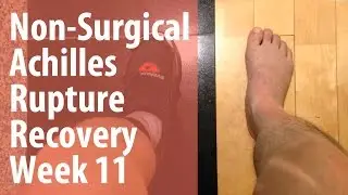 Non Surgical Achilles Rupture Recovery Week 11 - Physiotherapy