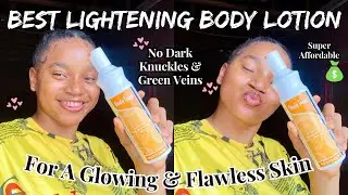 SAFE & EFFECTIVE LIGHTENING LOTION WITH BEST RESULTS FOR SKIN | Clears Dark Spots | Body Treat