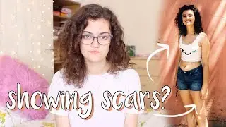 Should We Hide Our Self Harm Scars?