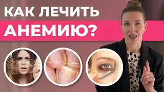 Как ПРАВИЛЬНО лечить анемию? Всё о симптомах, причинах и профилактике!