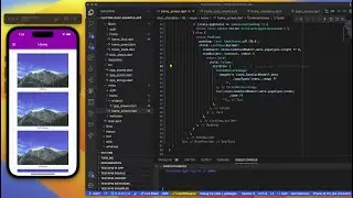 Flutter - 74. Bloc Pattern ile Veri Çekme
