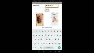 ASCDS Application for Automatic Skin Cancer Detection System