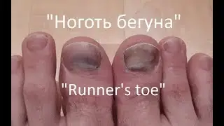 How to avoid 