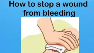 How to stop a wound from severe bleeding