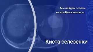 Spleen cyst