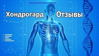 Хондрогард отзывы