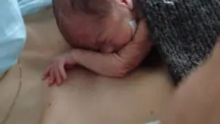 Недоношенный малыш и шерсть