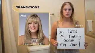 Teenage Female Hair Loss - Transitions of Indiana