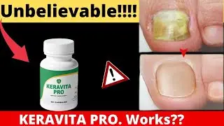 Keravita Pro Reviews 2022  Real Scam Risks No One Is Talking About