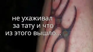 ВОСПАЛЕНИЕ НА ТАТУ!!! Клиент не ухаживал за татуировкой и вот что из этого получилось...