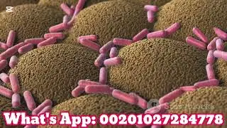 Plague disease journey