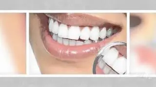 домашние отбеливание зубов   - Отбелите зубы за 1 неделю?