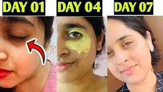 7 DAYS DARKCIRCLE REDUCE CHALLENGE IN TAMIL|கருவளையங்கள் 7 நாட்களிலே நீங்கும்😱