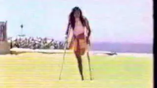 Amputee Dusty 3
