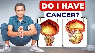 Urologist explains: 5 signs of prostate cancer that are easy to miss!