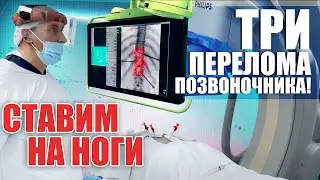 A DAY IN THE LIFE OF A NEUROSURGEON | How to treat a spinal fracture?