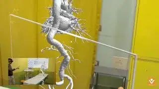 HoloSIRM