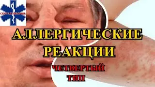 Четвертый тип аллергической реакции