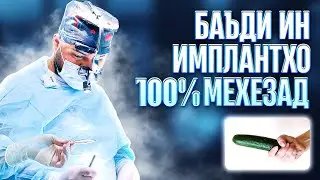 Мардонаги намехезад мана имплант 100% мехезонад!