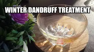 How To Get Rid Of Dandruff Permanently | Result in 1st wash | 100% Natural & Effective