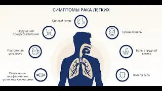 Важные симптомы рака легких