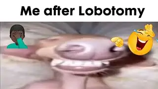 Me after Lobotomy