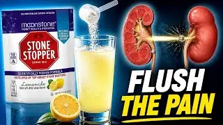 Moonstone Stone Stopper REAL review + how to prevent kidney stones