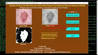 Skin Disease Detection Using CNN Convolutional Neural Network Python OpenCV Project Source Code