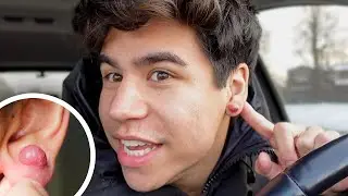im getting plastic surgery on my ear