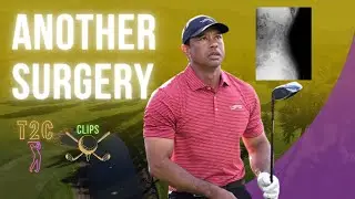 Tiger Woods Surgery Update | What It Means for His Future in Golf