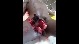 Southern Cameroons Police Brutality Archives