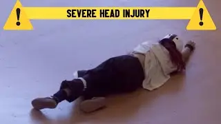 Severe Head Injury (Gablor Demon) By Trifoon Geometry Dash 2.2 check steam AAAAAAAAA