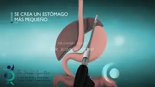 Descubre como hacemos un BAGUA en el  Programa Cirubar