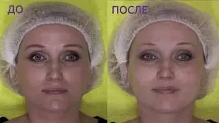 Мастер класс по применению лифтинг масок «Преображение» от ТЕНТОРИУМ