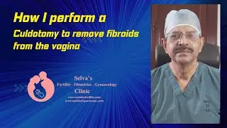 How I perform a culdotomy to remove fibroids from the vagina