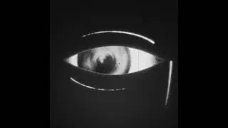 eyeball