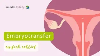 Alles, was du über den Embryotransfer wissen musst 👶💡