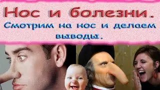Нос и болезни. Смотрим на нос и делаем выводы.